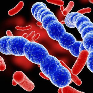 Galactosemia – גלקטוזמיה