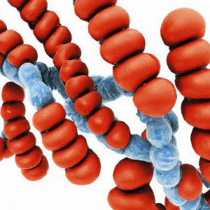 תסמונת ריפסום (Refsum Disease)