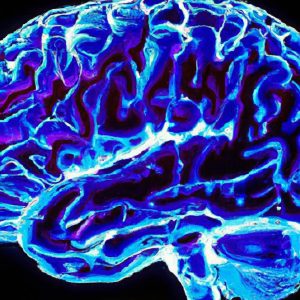 סרטן המוח (גליובלסטומה) (Glioblastoma)