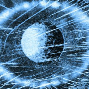 תסמונת ברדט-בידל (Bardet-Biedl Syndrome)