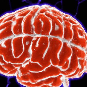 מחלת קושינג (Cushing's Disease)