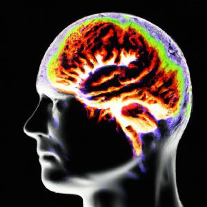 אלצהיימר מתקדם (Advanced Alzheimer's Disease)