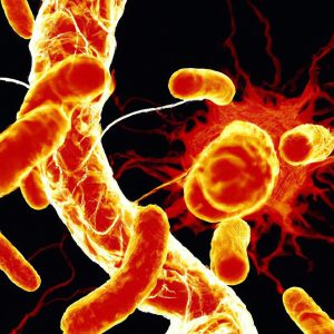 מחלת אלכסנדר (Alexander Disease)