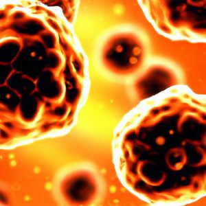 מחלת נימן-פיק סוג C (Niemann-Pick Disease Type C)